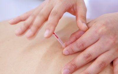 山村式不妊鍼灸イメージ