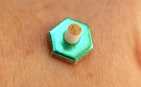 お灸をしているところ